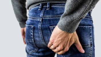 Hemorrhoids: Causes, Symptoms, and Effective Home Remedies for Relief