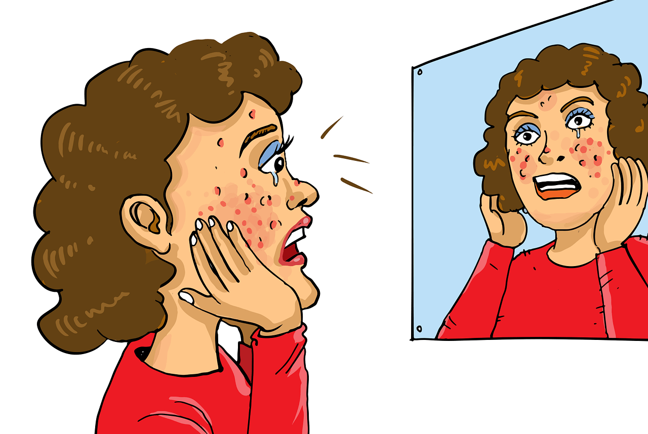 Natural home remedies for hormonal acne flareups — azelaic acid, niacinamide, and tea tree oil ingredients.